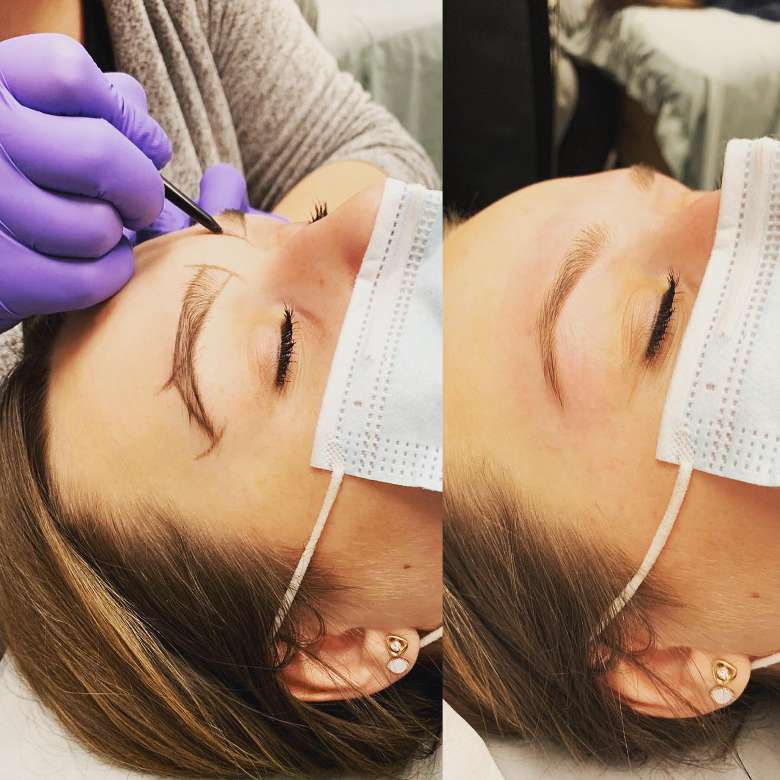 side by side images of woman receiving eyebrow treatment