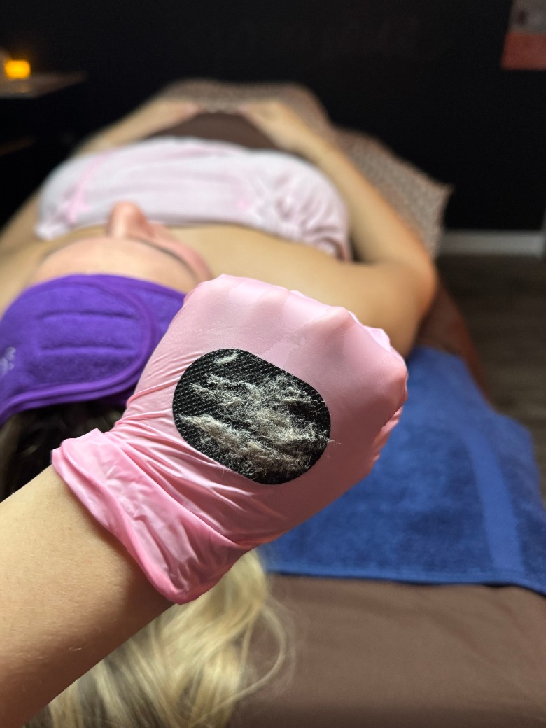 This picture shows the results of dermaplaning. On the glove are dead skin cells and peach fuzz. Removing it will allow for better product absorption.