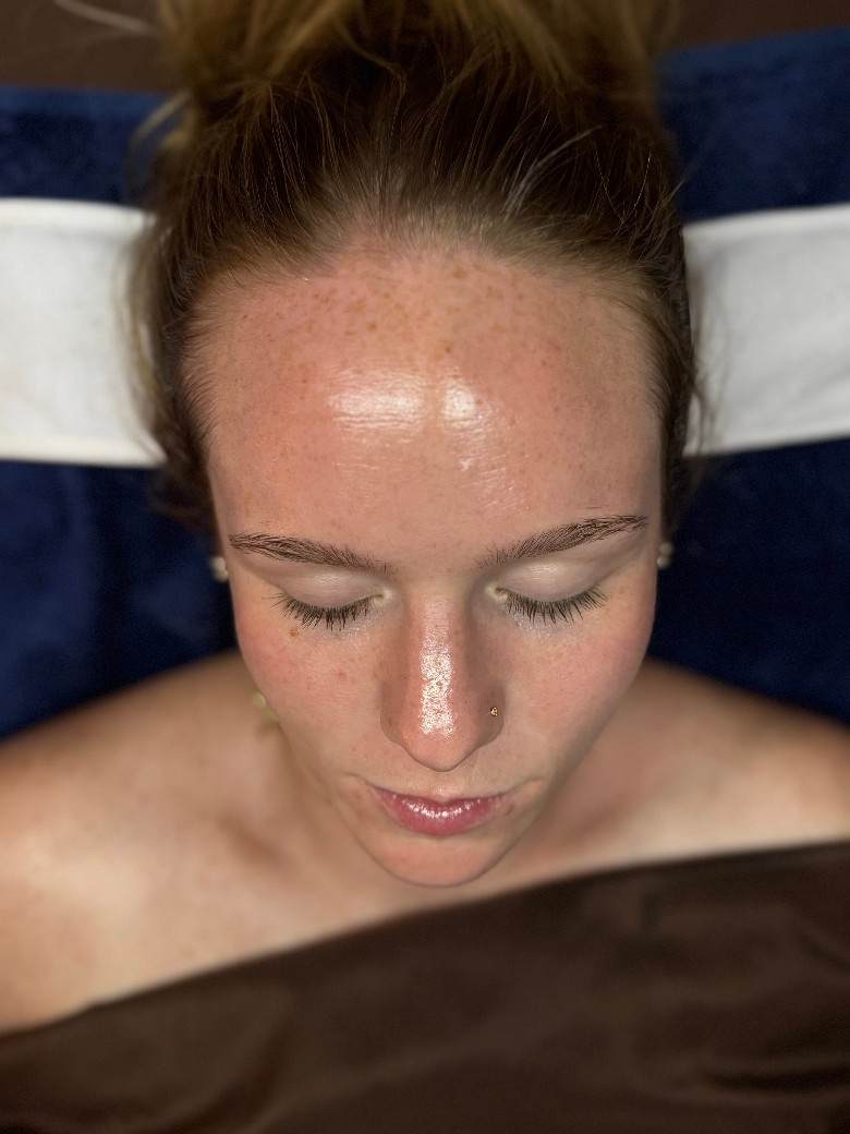 This client&rsquo;s skin looks amazing after a personalized home care routine and two facials.